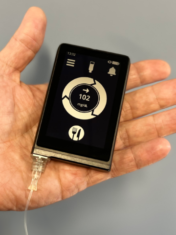 the bionic pancreas rests in a person's hand