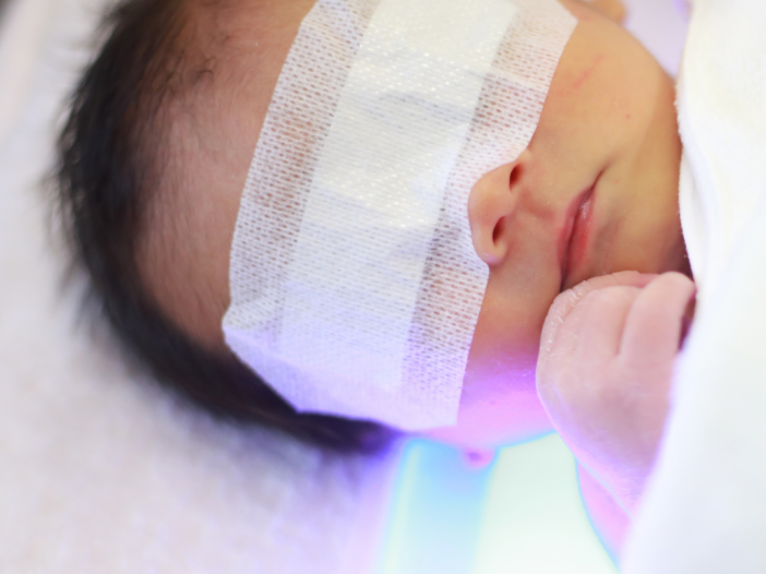 What are the causes and symptoms of jaundice?