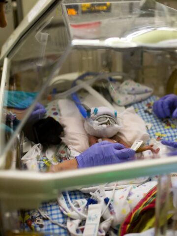 Rady Children’s sees success with new drug-free treatment of opioid-addicted newborns