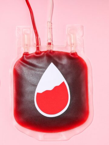 Sibling donors reduce chances of graft-versus-host disease